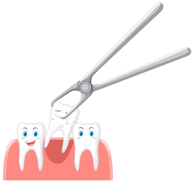 Cartoon teeth extraction