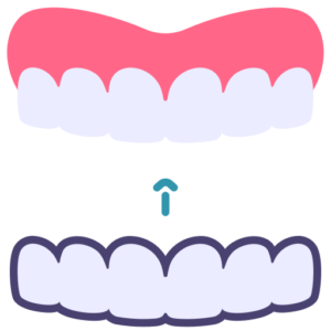 Aligners